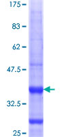 12.5% SDS-PAGE Stained with Coomassie Blue.